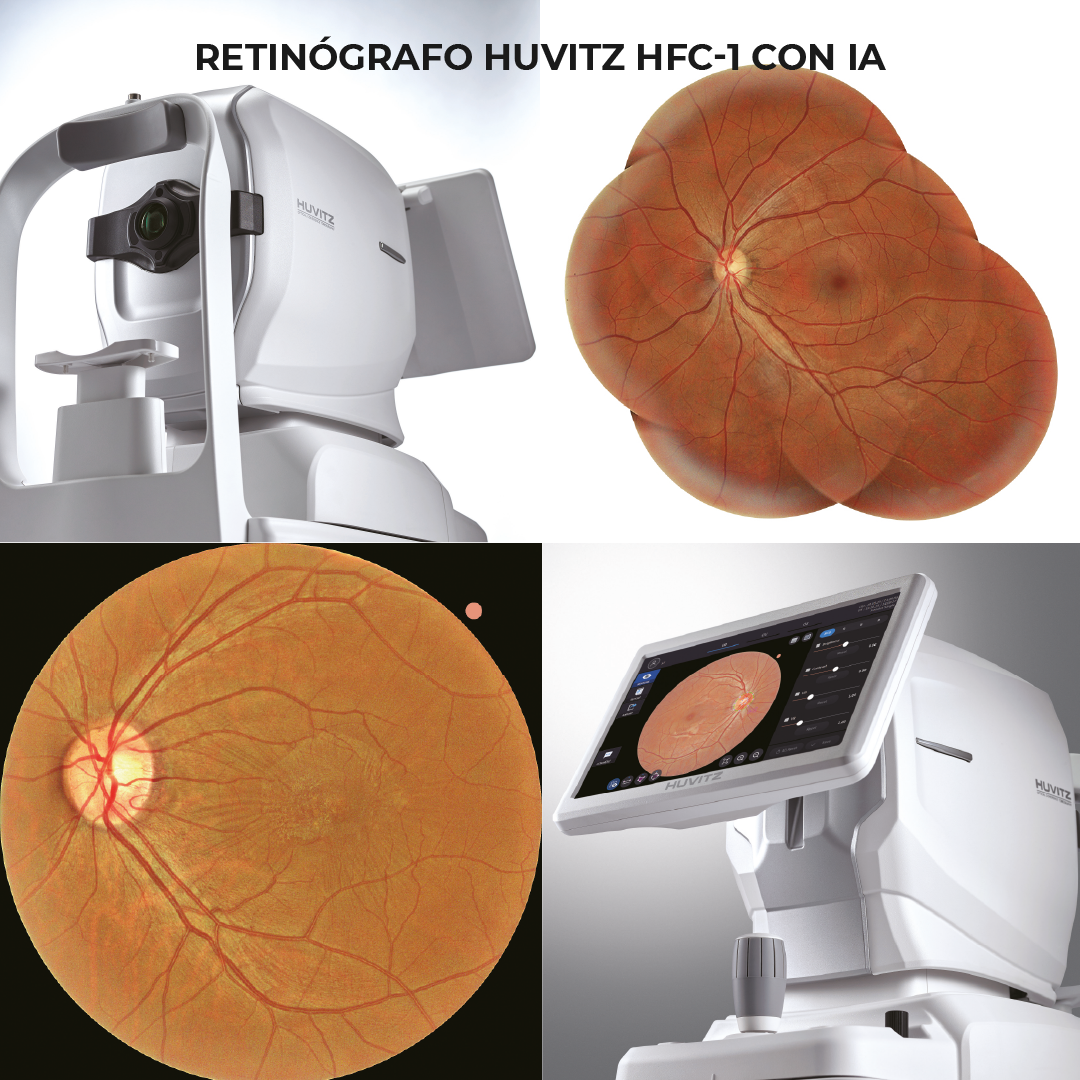 RETINÓGRAFO HUVITZ HFC-1 CON IA